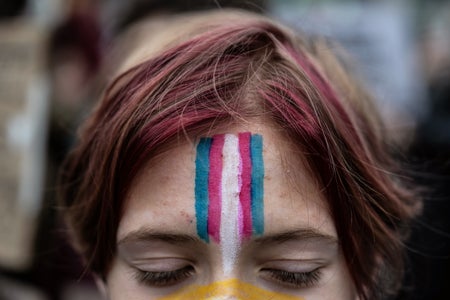 Close up photograph of a demonstrator with a face painting of the trans flag during the Rise Up for Trans Youth rally against President Donald Trump's executive actions targeting transgender people at Union Square in New York, US, on Saturday, Feb. 7, 2025